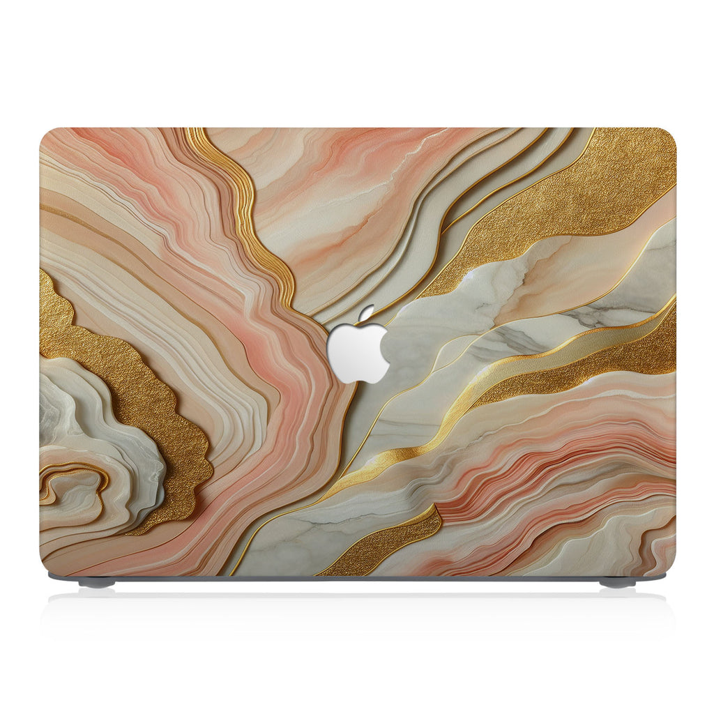 This lightweight, slim hardshell with Marble design is easy to install and fits closely to protect against scratches