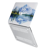 hardshell case with Watercolor View design has rubberized feet that keeps your MacBook from sliding on smooth surfaces